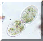 protozoa.jpg (21804 byte)